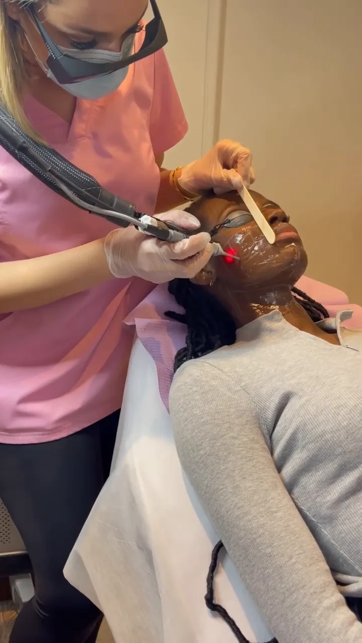 Épilation laser — SHAY Esthétique, Ahuntsic Montréal
