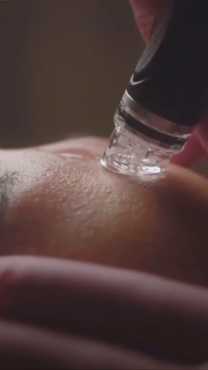 Soin Hydrafacial® — SHAY Esthétique, Ahuntsic Montréal